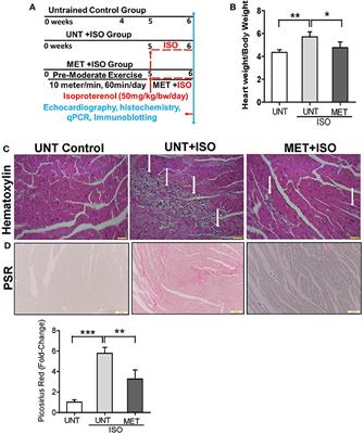 Exercise Mediated Nrf2 Signaling Protects the Myocardium From Isoproterenol-Induced Pathological Remodeling